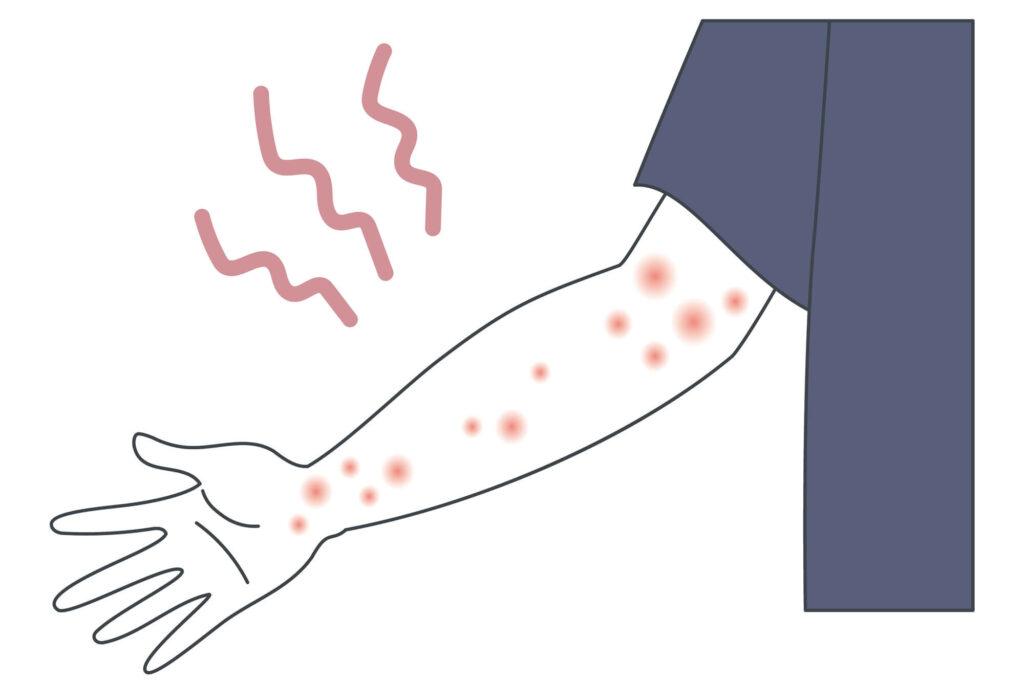 ３．帯状疱疹は身体のどこで発症する？