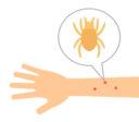 ダニに刺されたらどうなるの？キレイに治す方法や駆除方法を紹介 | セゾンのくらし大研究