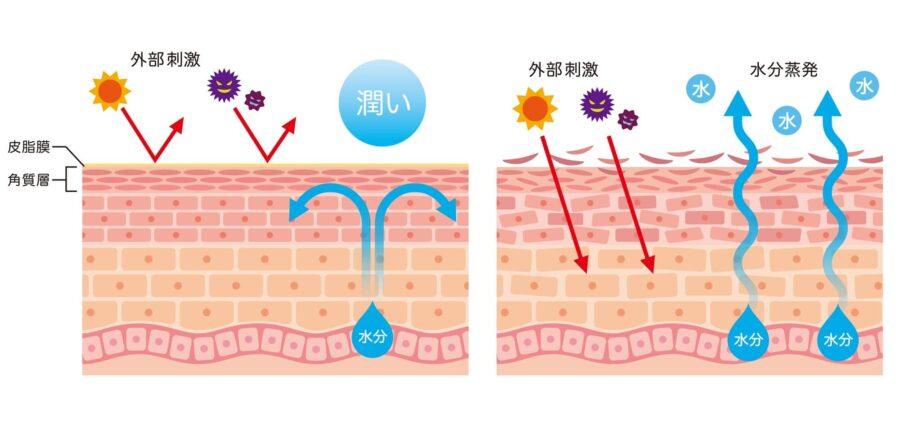 【医師監修】完全網羅!深刻な乾燥肌を改善する方法10選!肌の水分が減る5つの原因を徹底解説 | セゾンのくらし大研究