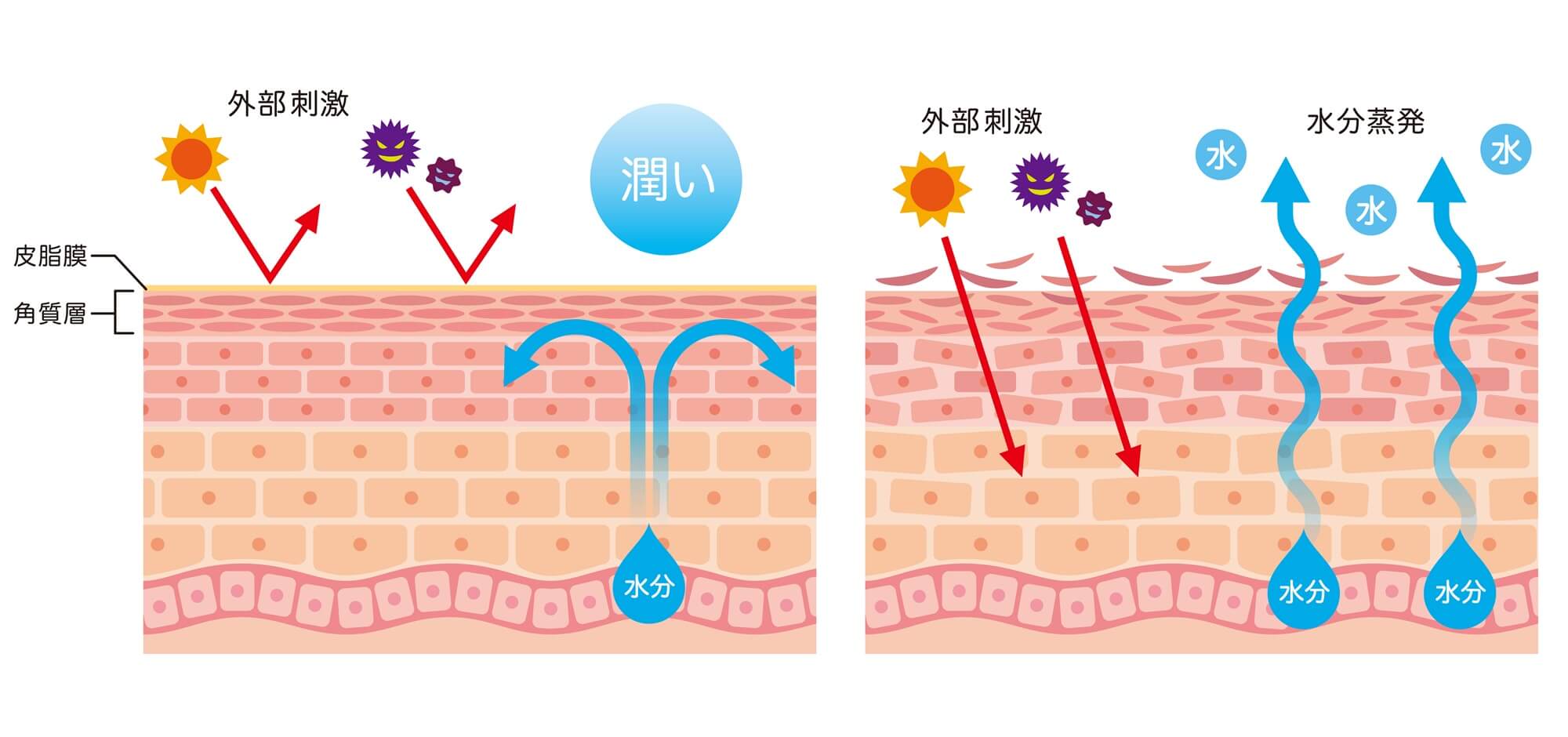 【医師監修】完全網羅!深刻な乾燥肌を改善する方法10選!肌の水分が減る5つの原因を徹底解説 | セゾンのくらし大研究