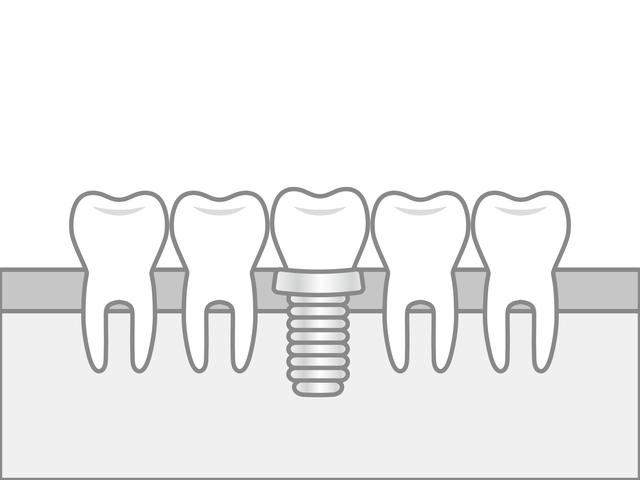 【項目別】歯医者の治療費の相場
