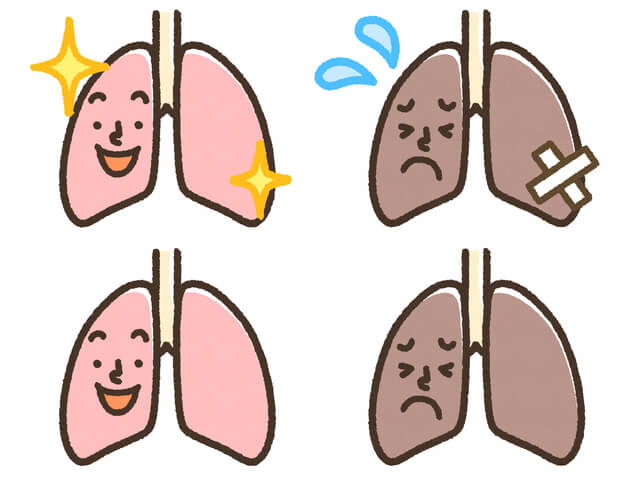 どのぐらいの人が肺がんになる？