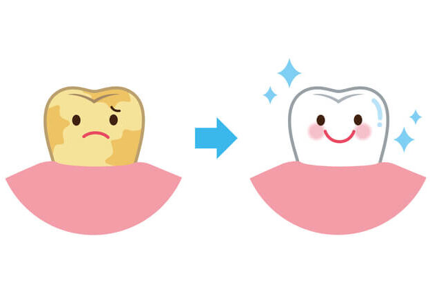 歯の着色の予防と対策