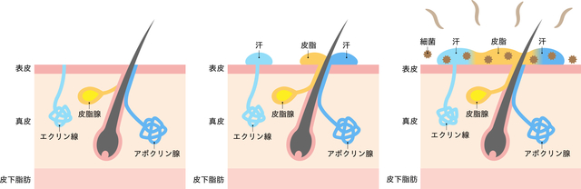 汗はにおう？体臭の発生メカニズム