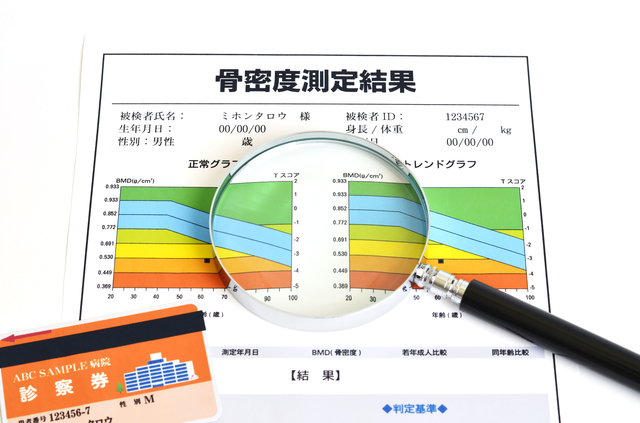 骨粗しょう症と診断されたら